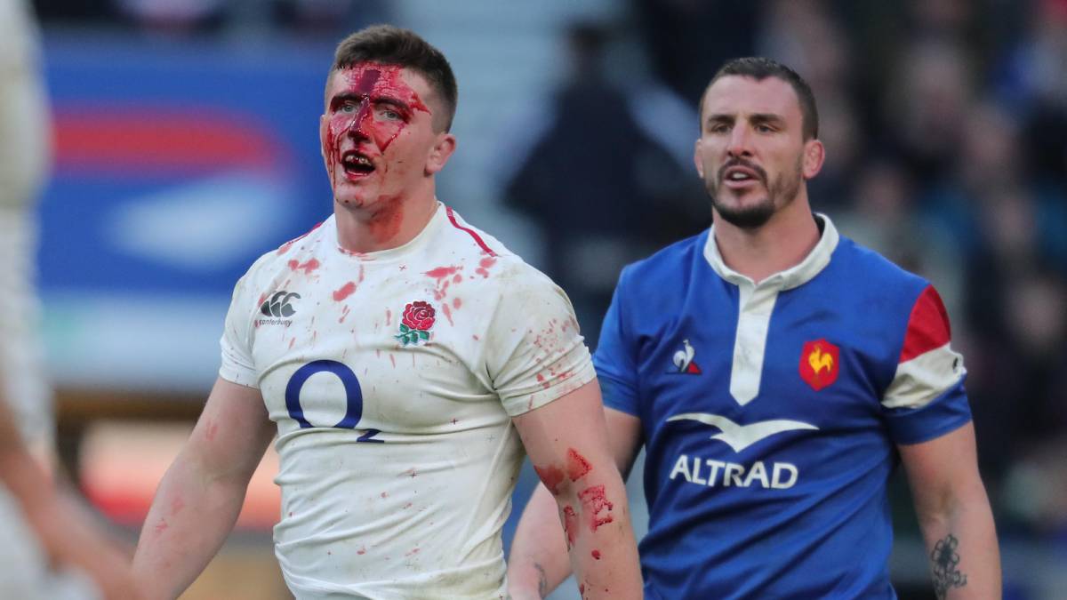 Top10: Die gefährlichsten Sportarten - Rugby